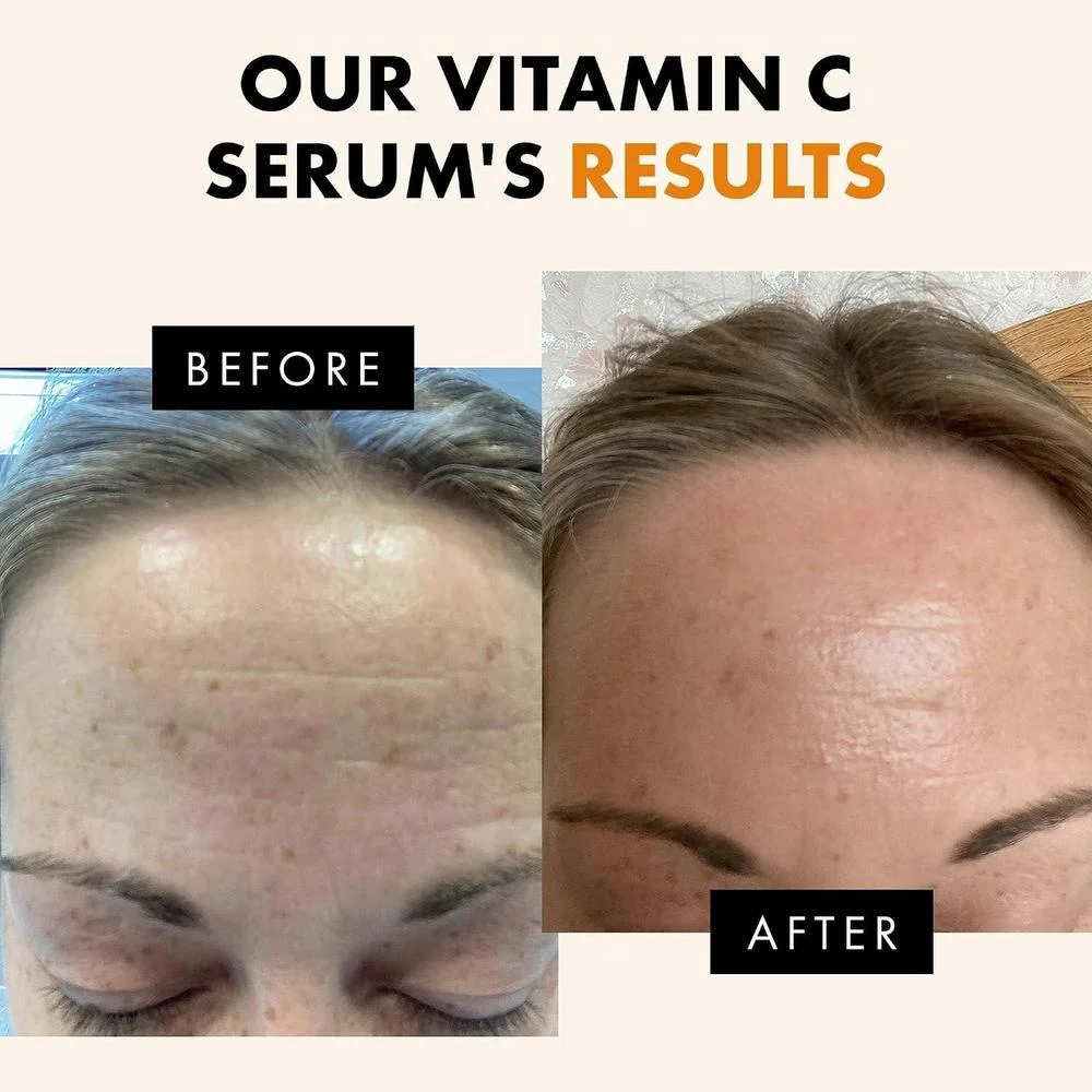 Suero Iluminador Con Vitamina C 30ml