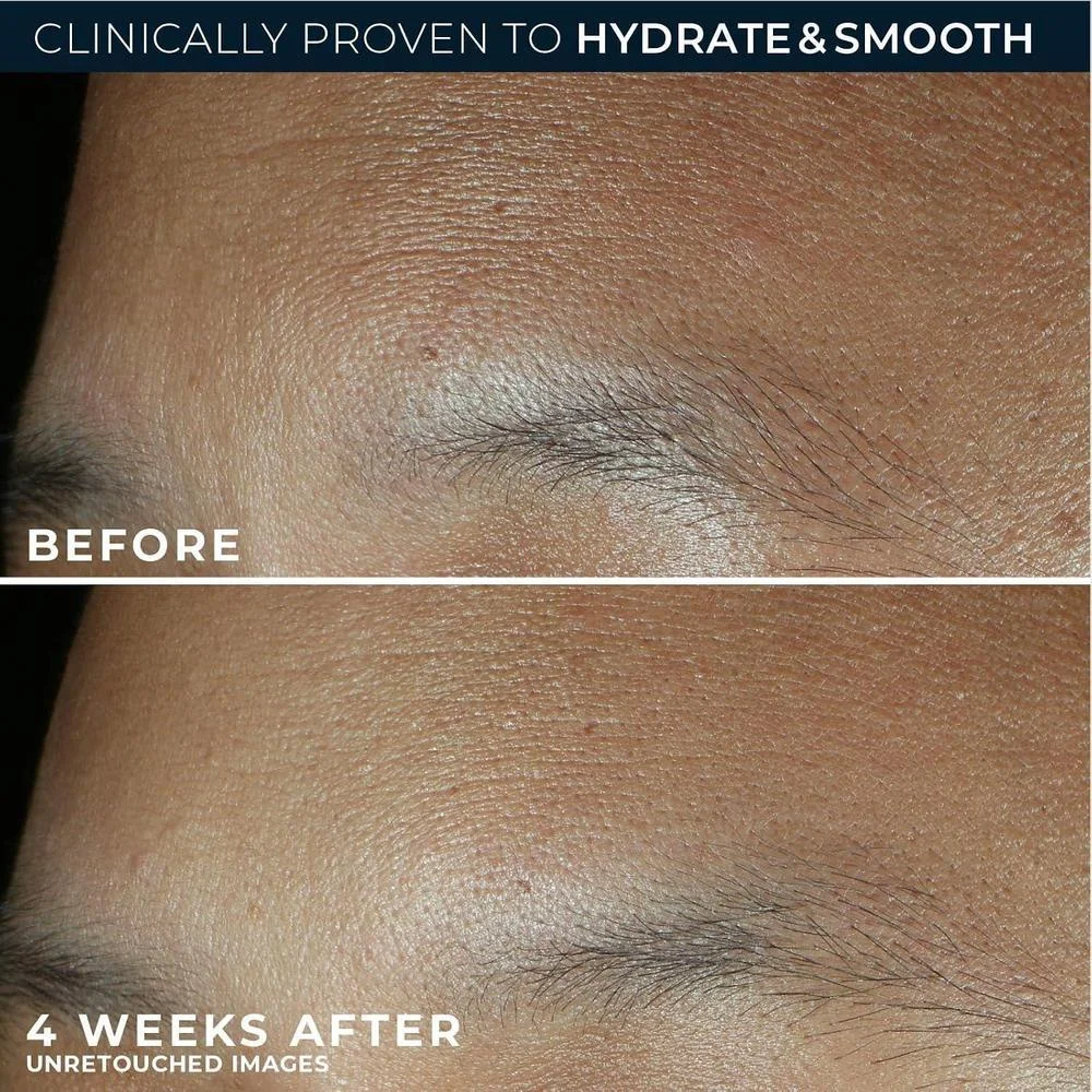 Roc Hidratante Facial Retinol Correxion Ácido Hialurónico 1.7oz