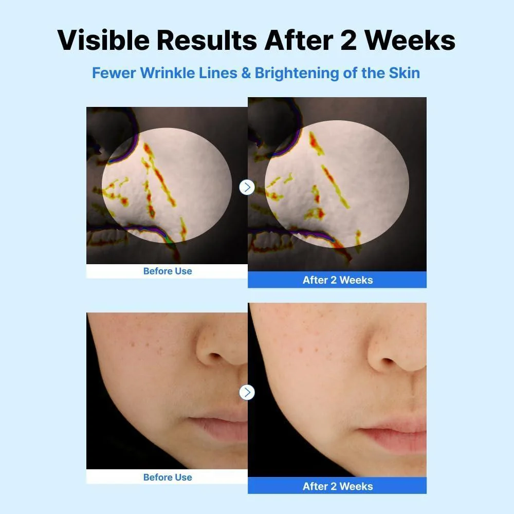 NIDA Youthful Glass Skin Combo con crema hidratante y sueros para lograr una piel juvenil y radiante