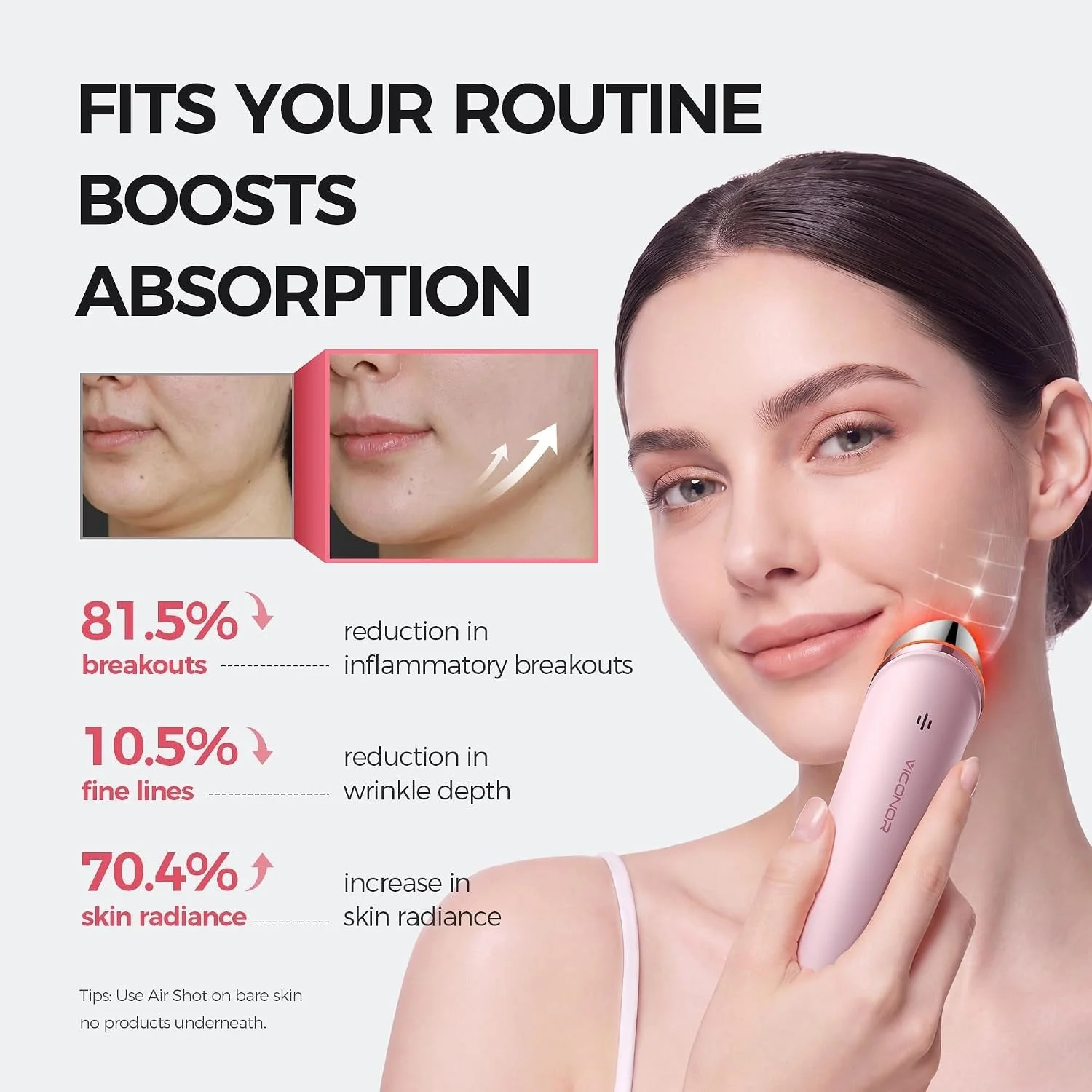 Viconor Red Light Therapy Wand, 6-in-1 Beauty Device for All Skin Types Women Gifts