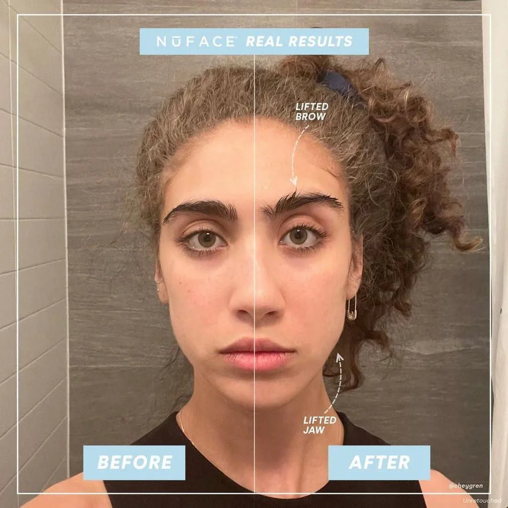 Dispositivo portátil NuFACE Mini para tonificación de la piel del rostro, mejora el contorno y reduce líneas finas