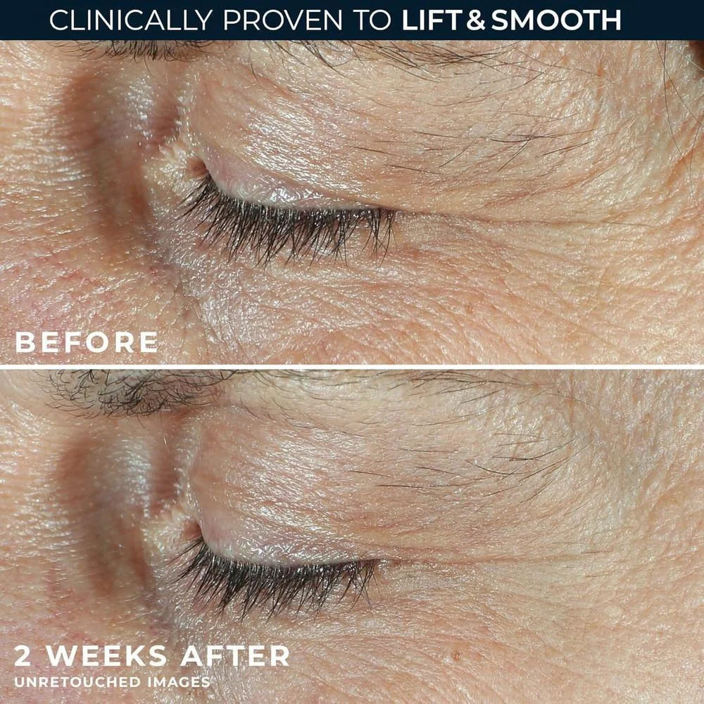 Roc Crema Para Ojos Retinol 20ml