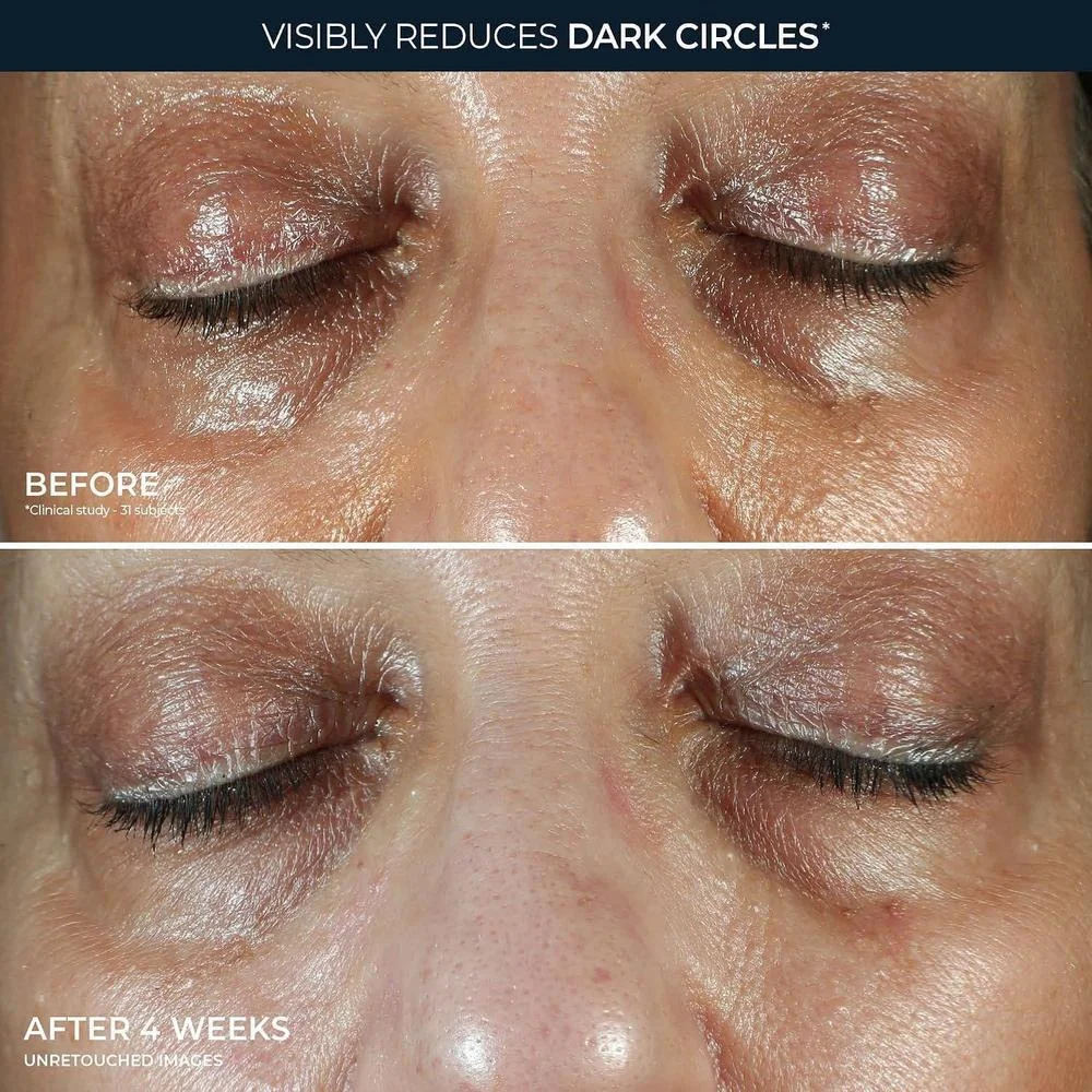 RoC Multi Correxion Crema de ojos antienvejecimiento para hinchazón y ojeras con manteca de karité