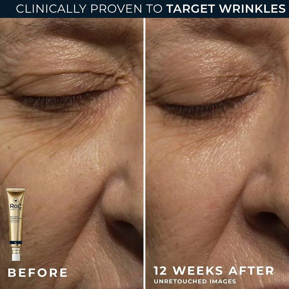 Conjunto Roc: Crema De Noche Y Ojos Con Retinol + 45ml