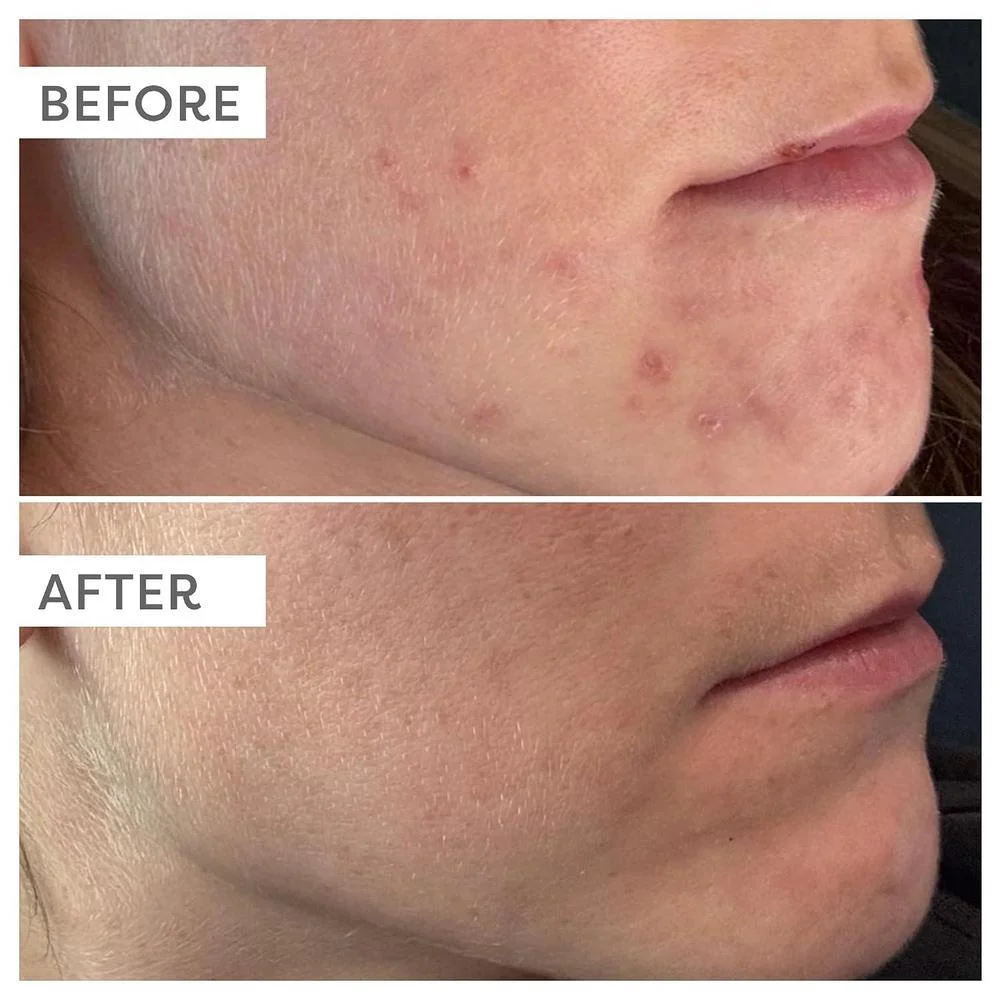 Suero Facial TruSkin Vitamina C Ácido Hialurónico Vitamina E 30ml