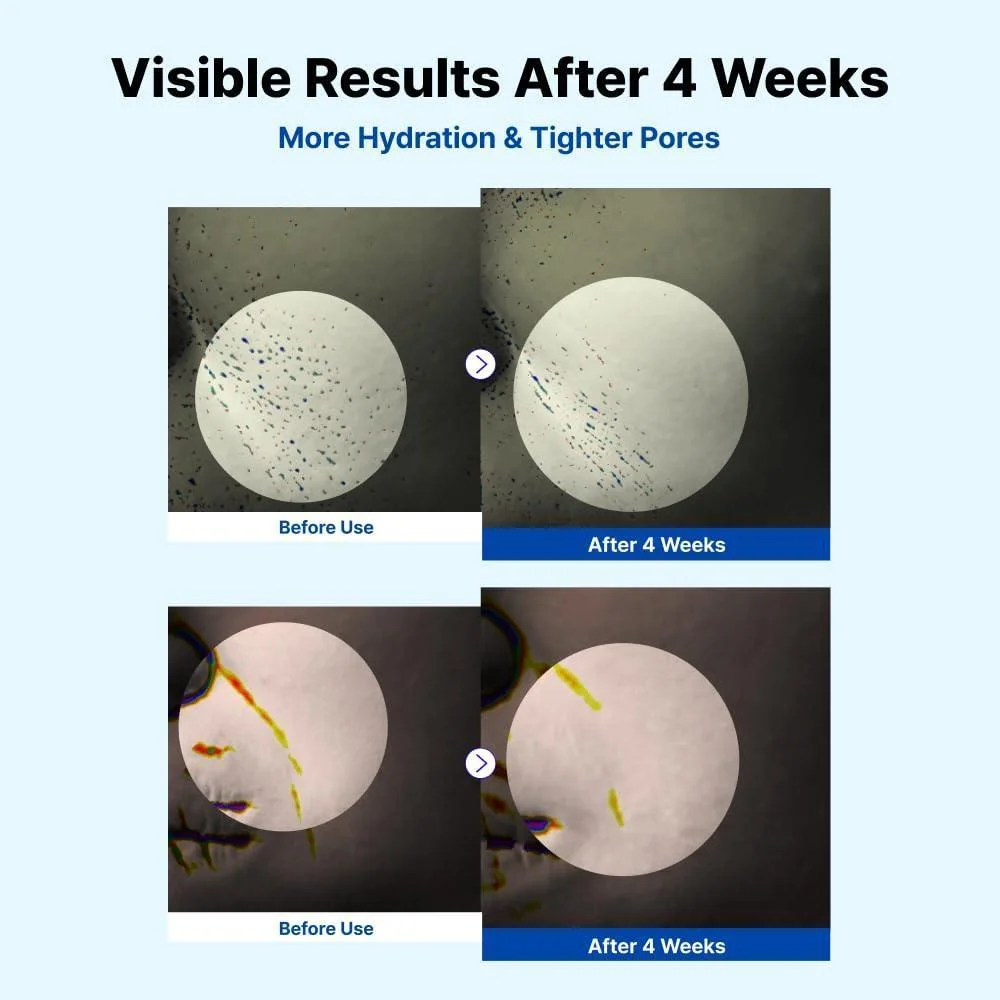 NIDA Youthful Glass Skin Combo con crema hidratante y sueros para lograr una piel juvenil y radiante