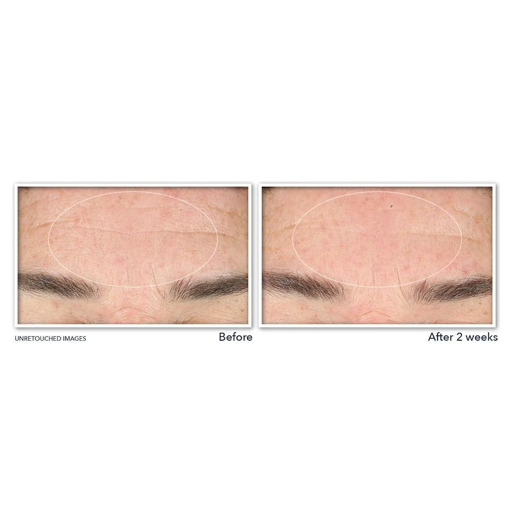 RoC Derm Correxion Serum Limpiador Facial Niacinamida 6oz