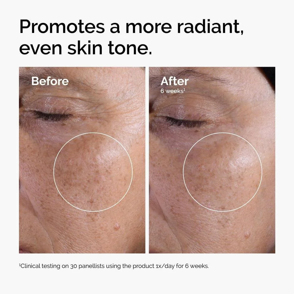 The Ordinary Tónico Exfoliante De Ácido Glicólico 7%, Mejora Luminosidad E Ilumina La Piel