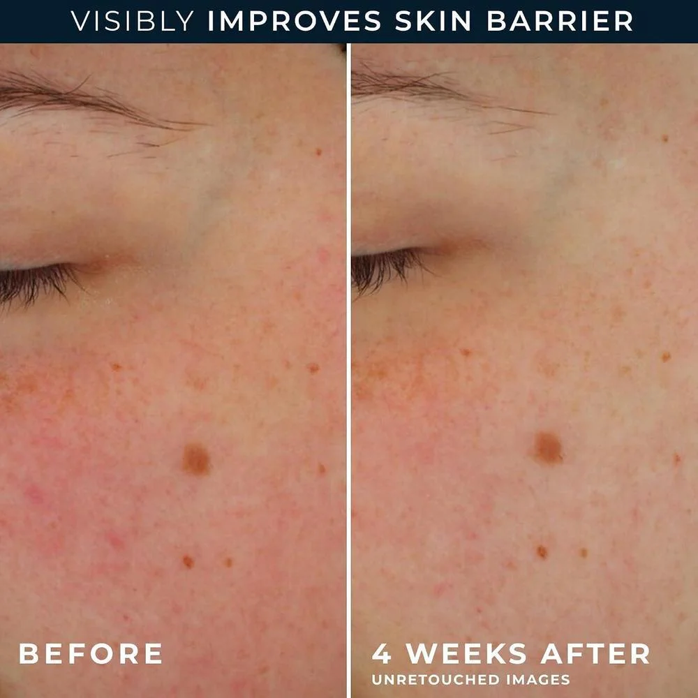Roc Barrier Renew Con Spf 30, Crema Hidratante Y Protectora Con Ceramidas Y Prebióticos Para Todo Tipo De Piel, 70.87 G
