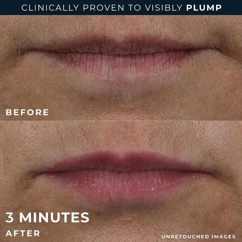 RoC Derm Correxion Lip Volumizer, tratamiento labial con ácido hialurónico y vitamina E, incluye crema suavizante de ojos