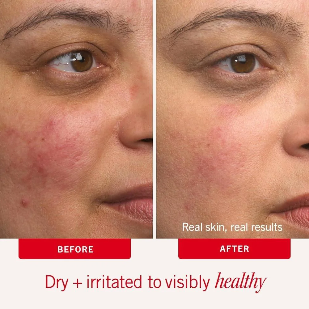First Aid Beauty Ultra Repair Cream Hidratante Intenso con Avena Coloidal para Eczema y Piel Seca, Sin Fragancia