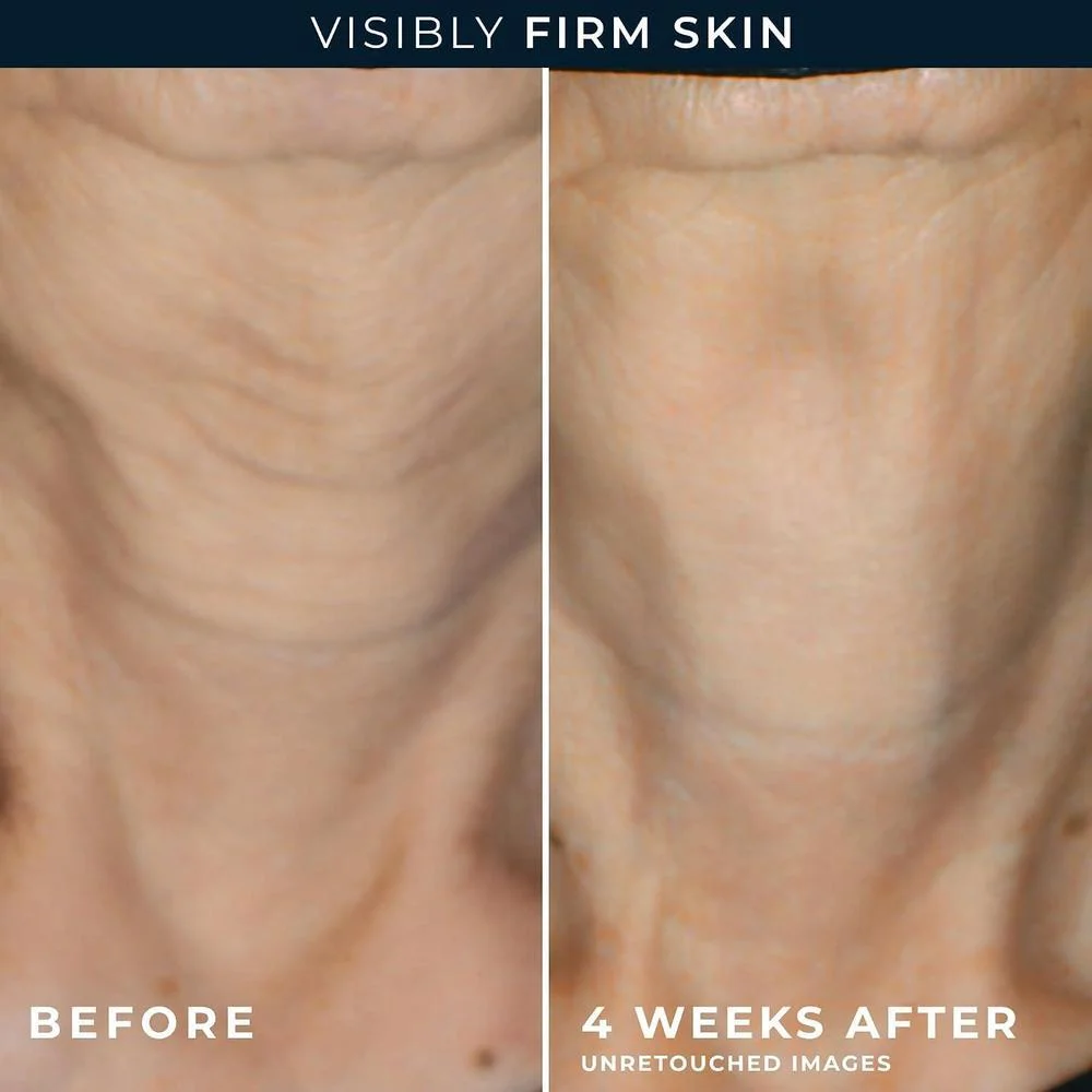 RoC Crema diaria antienvejecimiento para arrugas en rostro y cuello con cápsulas de retinol para suavizar líneas de expresión