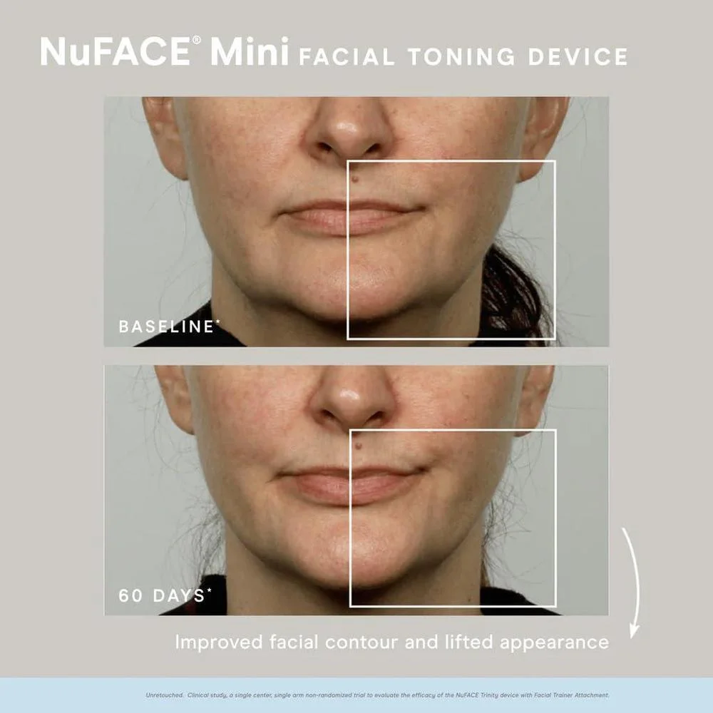Dispositivo portátil NuFACE Mini para tonificación de la piel del rostro, mejora el contorno y reduce líneas finas